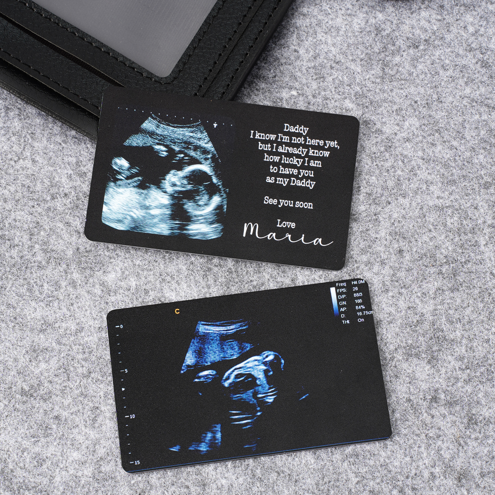 Carte de portefeuille photo échographie personnalisée avec nom grossesse annonce de bébé Cadeau de douche de bébé pour nouveau papa