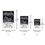 Personalized Baby Ultrasound Photo Building Block Puzzle with Name Date and Text Mother's Day Gift for Expecting Moms Mothers