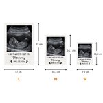 Puzzle de bloc personnalisé avec photo et textes - Cadeau de la fête des Mères pour les futures mamans